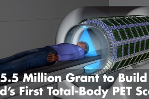 Total body pet scanner